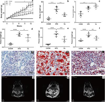 <mark class="highlighted">Vanillin</mark> Alleviates High Fat Diet-Induced Obesity and Improves the Gut Microbiota Composition